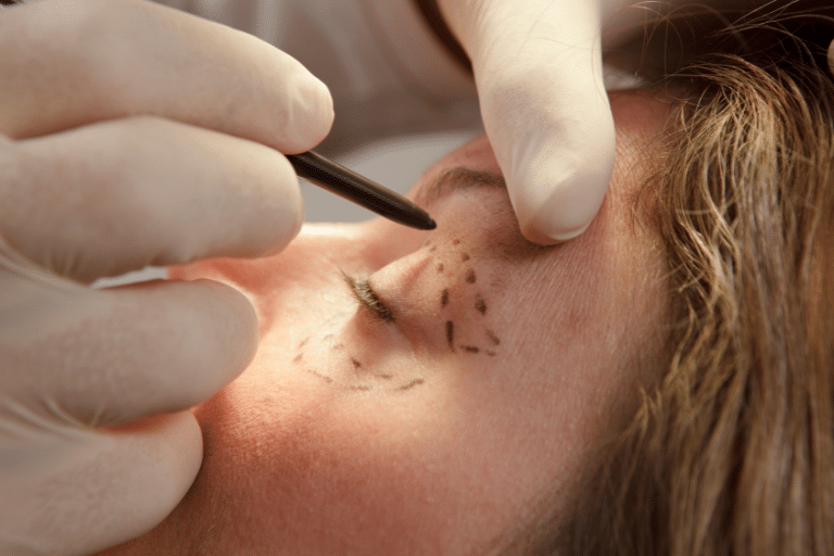Cosmetic Surgery and Medical Malpractice Claims
